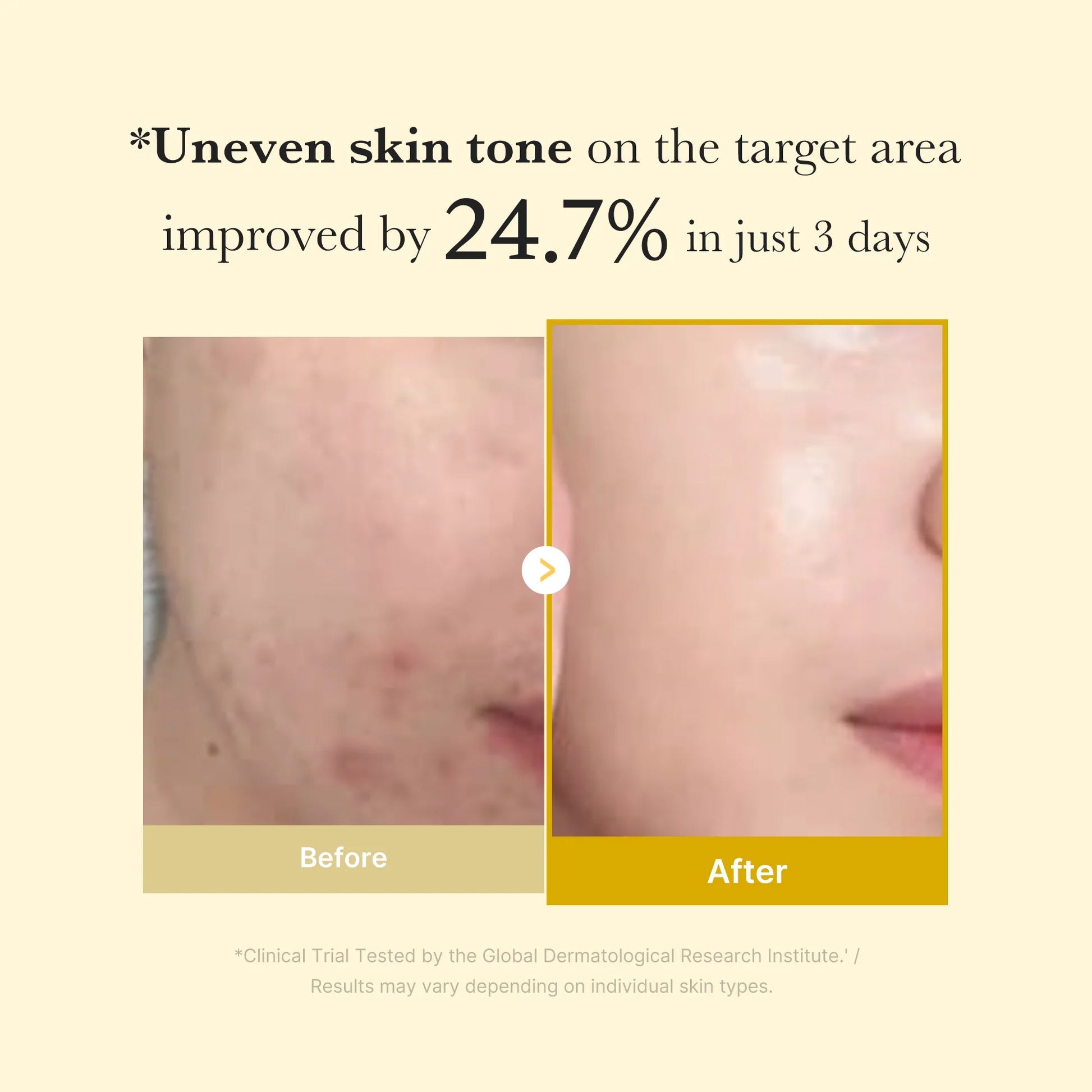 Acid Turmeric Night Wrapping Mask