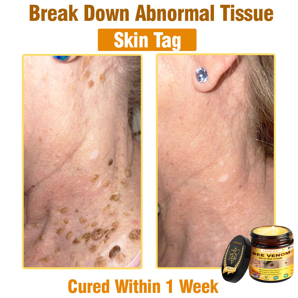 Bee Venom All-in-One Cream US Dermatologist Approved